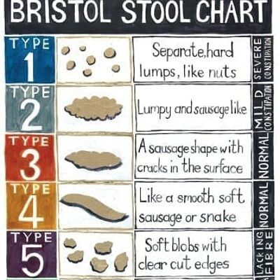 Gráfico de heces de Bristol Impresión de póster