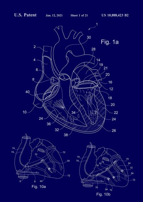 HEART PATENT PRINT: Medical Blueprint Artwork - 7 x 5" - Blue