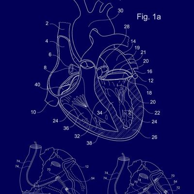 IMPRESSION DE BREVET DE COEUR : Illustration de plan médical - 7 x 5" - Bleu