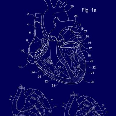 HEART PATENT PRINT: Medical Blueprint Artwork - 7 x 5" - Blue
