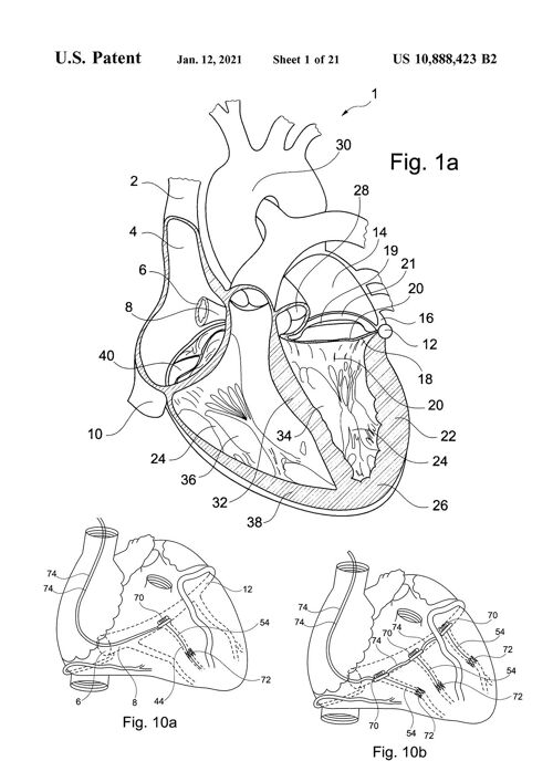 HEART PATENT PRINT: Medical Blueprint Artwork - 7 x 5" - White