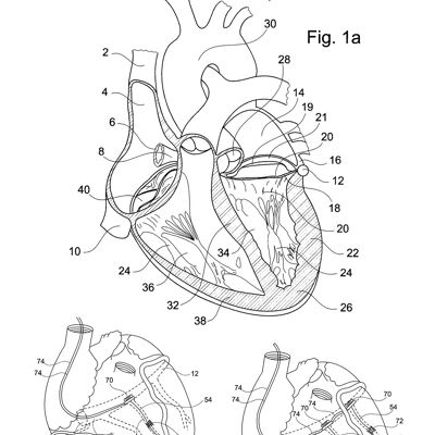 HEART PATENT PRINT: Medical Blueprint Artwork - 7 x 5" - White