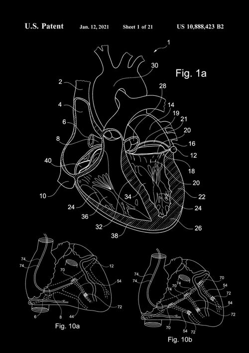 HEART PATENT PRINT: Medical Blueprint Artwork - 7 x 5" - Black