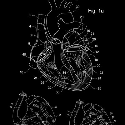 HERZ-PATENTDRUCK: Medical Blueprint Artwork – 7 x 5" – Schwarz