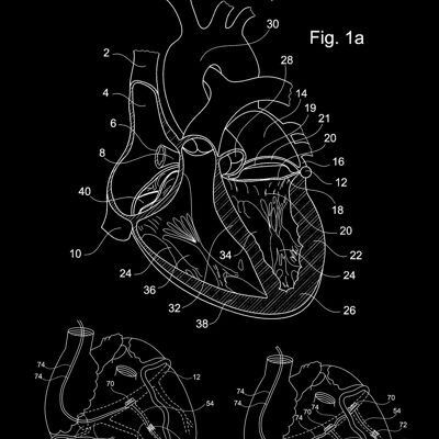 HEART PATENT PRINT: Medical Blueprint Artwork - 7 x 5" - Black