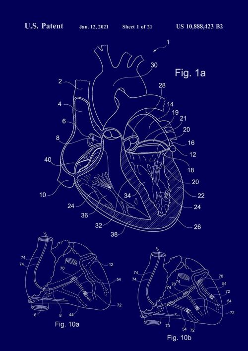 HEART PATENT PRINT: Medical Blueprint Artwork - A3 - Blue