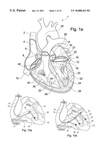 HEART PATENT PRINT : Medical Blueprint Artwork - A3 - Blanc