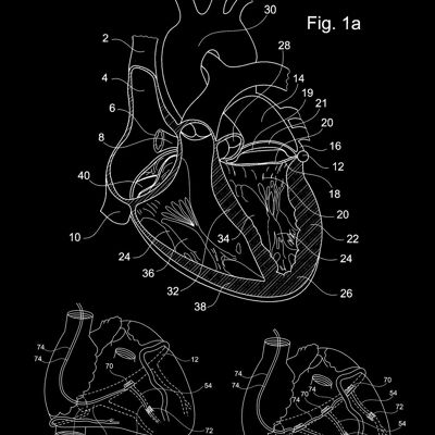 HEART PATENT PRINT: Medical Blueprint Artwork - A3 - Black