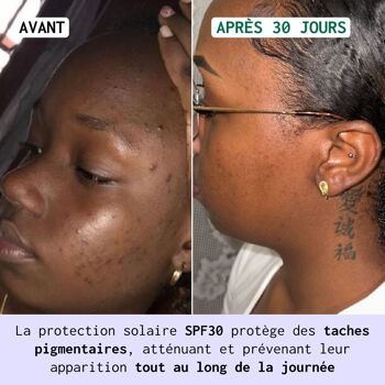 Soin Correcteur d'Hyperpigmentation Visage & Mains HRB-3,  Formule Jour, SPF 30, 50ml 4