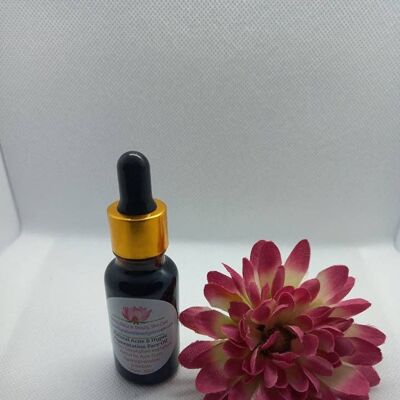 Natural Acne and Hyperpigmentation Oil (Tamanu + Acai Oil )