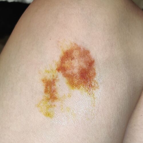 Big bruise temporary tattoo special effect makeup, fake scar tattoo, gore, halloween)