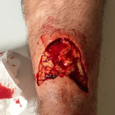 Large Laceration Open Wound  / Ragged / Torn/ Deep Cut / Fake Scar / SFX Makeup Silicone Prosthetic IPA Based,Content Creation - Desired FX