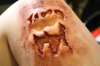 Prothèse en silicone encapsulée à base d'IPA pour morsure/déchirure de zombie 3