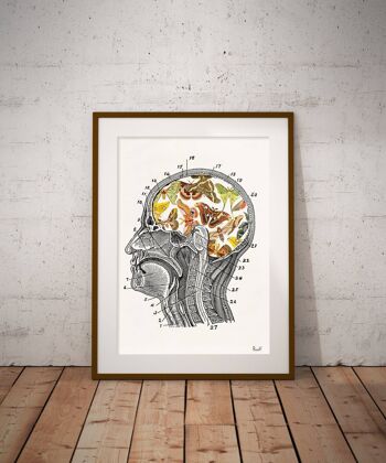 Papillons et mites sur mon cerveau Print - A4 White 8.2x11.6 (No Hanger) 3