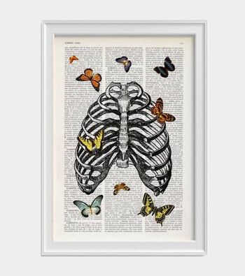 Papillons en cage thoracique - Blanc 8x10 (Sans Cintre) 4