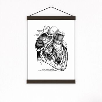 Coeur en noir - A5 Blanc 5.8x8.2 (Sans Cintre) 1