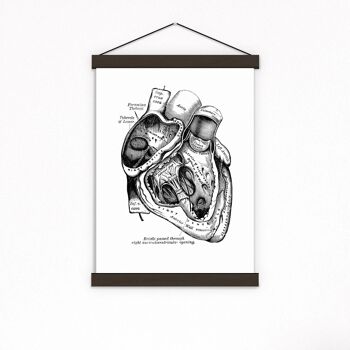 Coeur en noir - Blanc 8x10 (No Hanger) 1