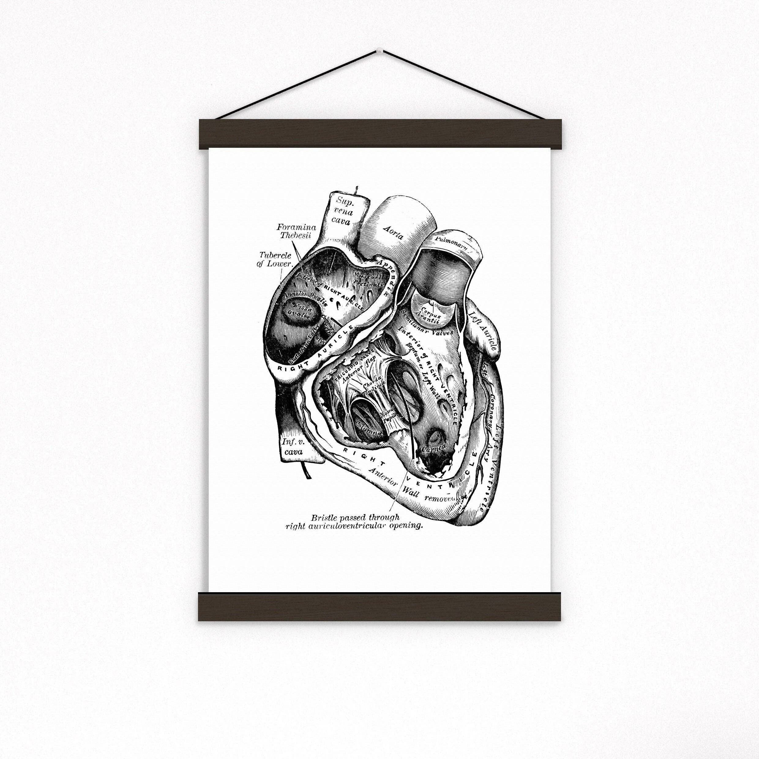 Cuore in nero - Bianco 8x10