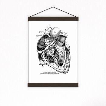 Cadeau pour la maison, impression d'art mural, art mural d'anatomie de section de coeur, impression de dictionnaire, cadeau pour le docteur, anatomie de coeur humain, coeur anatomique, SKA039 - page de livre M 6.4x9.6 (aucun cintre) 2