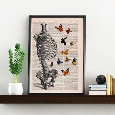 Xmas Svg - Stampa artistica da parete - Torso scheletro umano pieno di farfalle - Regalo di stampa anatomica - Decorazione anatomica - Arte della scienza - SKA095 - Pagina del libro L 8,1 x 12 (senza gancio)