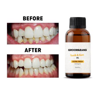 Groomarang Extra Strength Huile de traitement des dents et des gencives 15 ml, 12 2