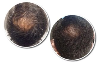 R12 Sérum Cheveux Actif Tri Peptide pour Homme 30 ml 5