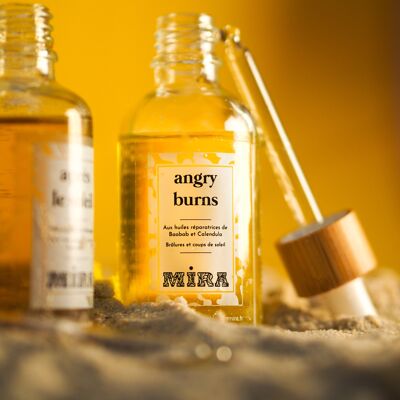 POST SUNBURN - Angry Burns - Aceite para quemaduras y quemaduras solares con 5 aceites vegetales - Rostro, cuerpo - Reconstituyente, regenerador, calmante - 50 ml