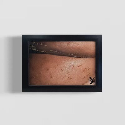 Framed Photography- Stretched, Pulled, Abused