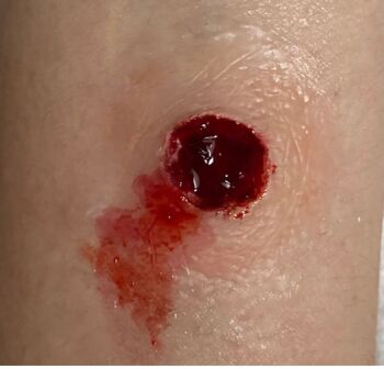 PROTHÈSE EN SILICONE SFX ENTRY BULLET WOUND 2