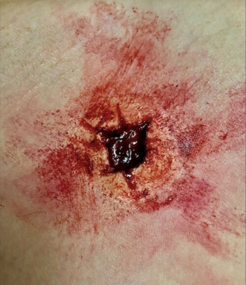 SFX EXIT BULLET WOUND SILICONE PROSTHETIC
