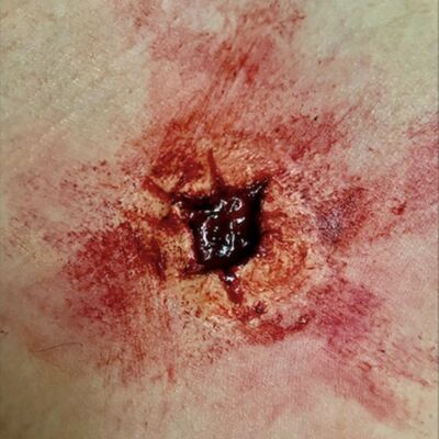 PROTESICA IN SILICONE SFX EXIT BULLET WOUND