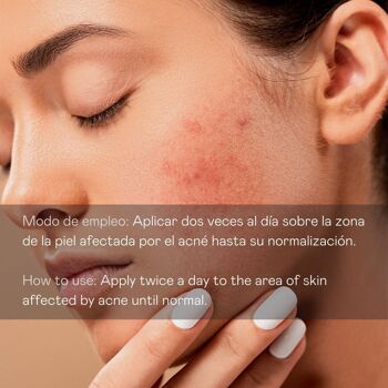 Sérum facial anti-acné direct - 30 ml 4