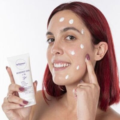 Tratamiento crema anti acne y espinillas Renewed Skin XL