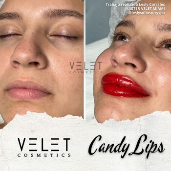 Lèvres VV | Bonbons Lèvres 2