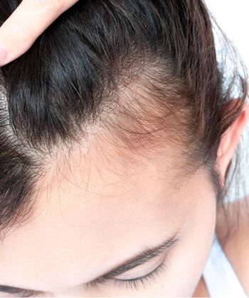 Compte-gouttes à base de gingembre - Stimule et renforce la croissance des cheveux | 120ml 8