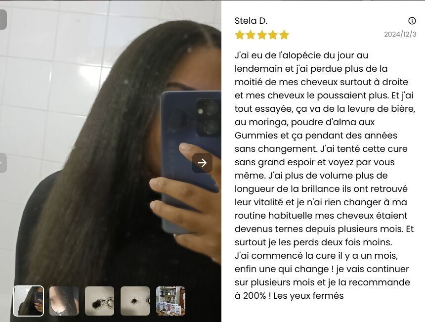 Cure Anti-Chute de Cheveux & Sommeil – IN YOUTH Kératine, Ginkgo & Curcuma