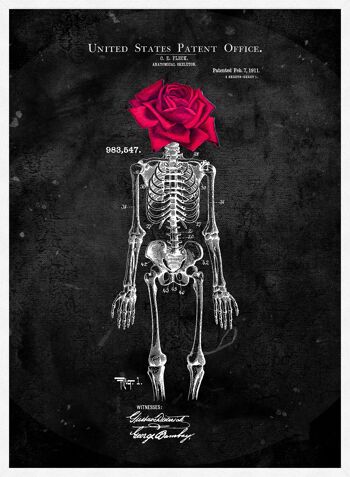 Squelette Rose Imprimé Noir - 50x70 - Mat 4