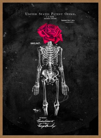 Squelette Rose Imprimé Noir - 50x70 - Mat 5