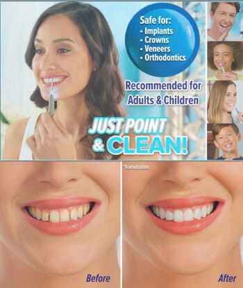 Nettoyant dentaire Blanchiment des dents 5