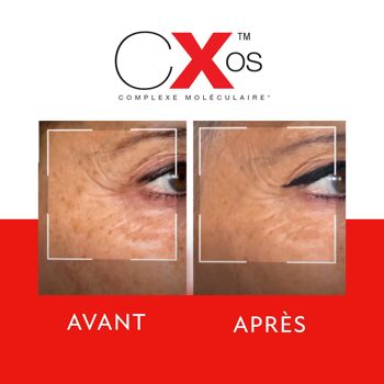 Soin zone oculaire correction globale CXOS™ 5