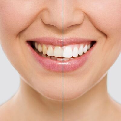 InnovaGoods Wripes Teeth Whitening Strips