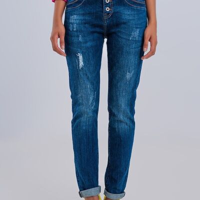 Jeans boyfriend strappati con bottoni a vista in blu scuro