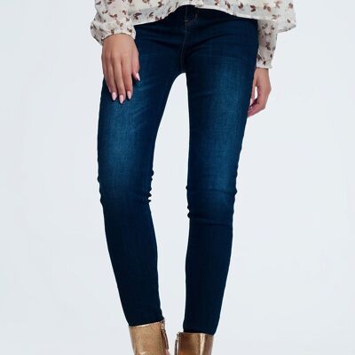 Jeans mit goldenen Seitendetails