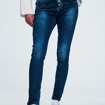 Blue jeans with button closure