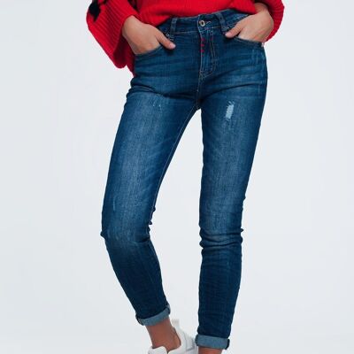 skinny jeans with wear detail