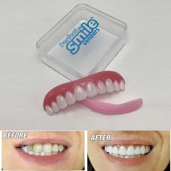 Dents de Remplacement Réutilisable et Amovible 6