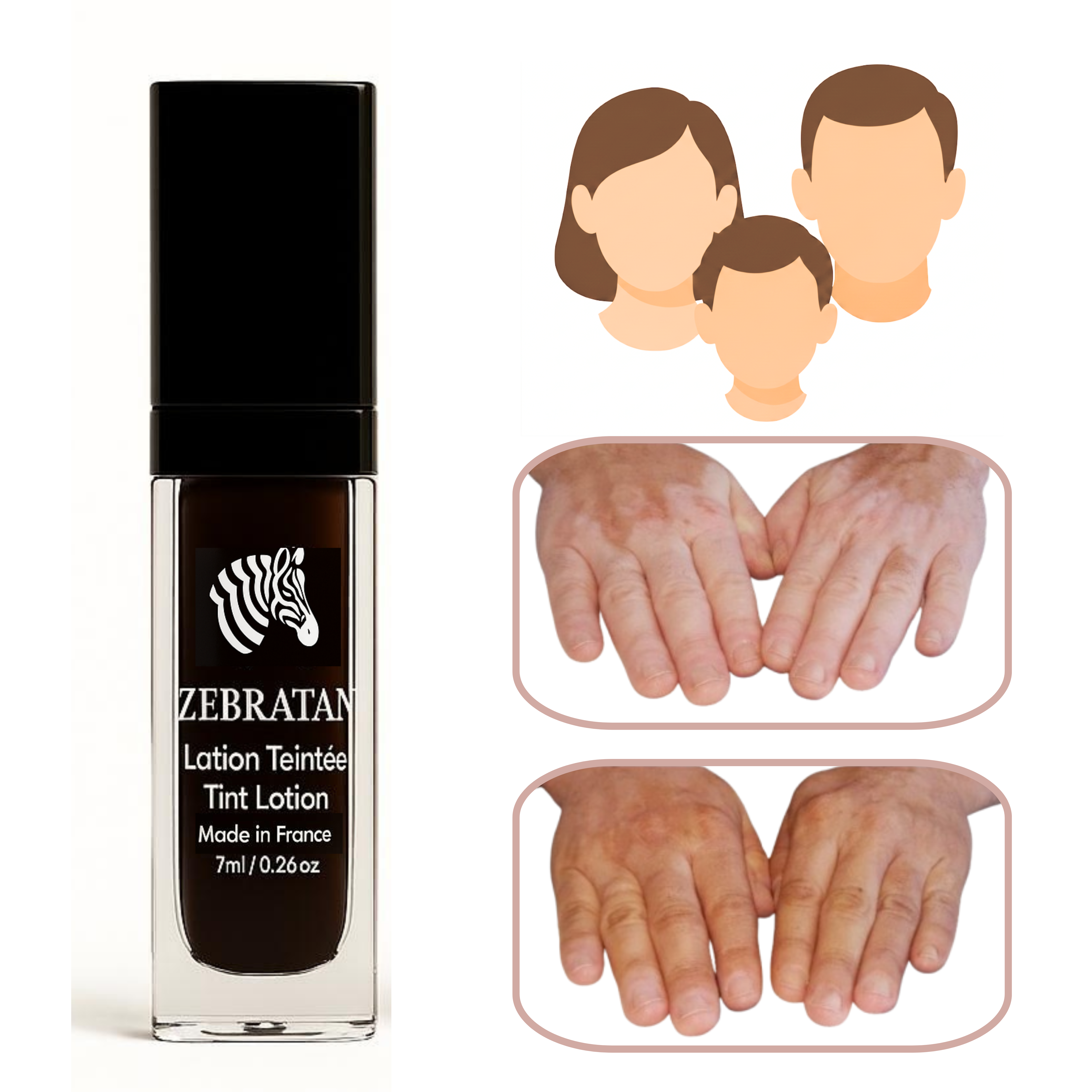 Zebratan Hellbeige – Unisex Vitiligo Make-up-Lotion für Gesicht und Körper