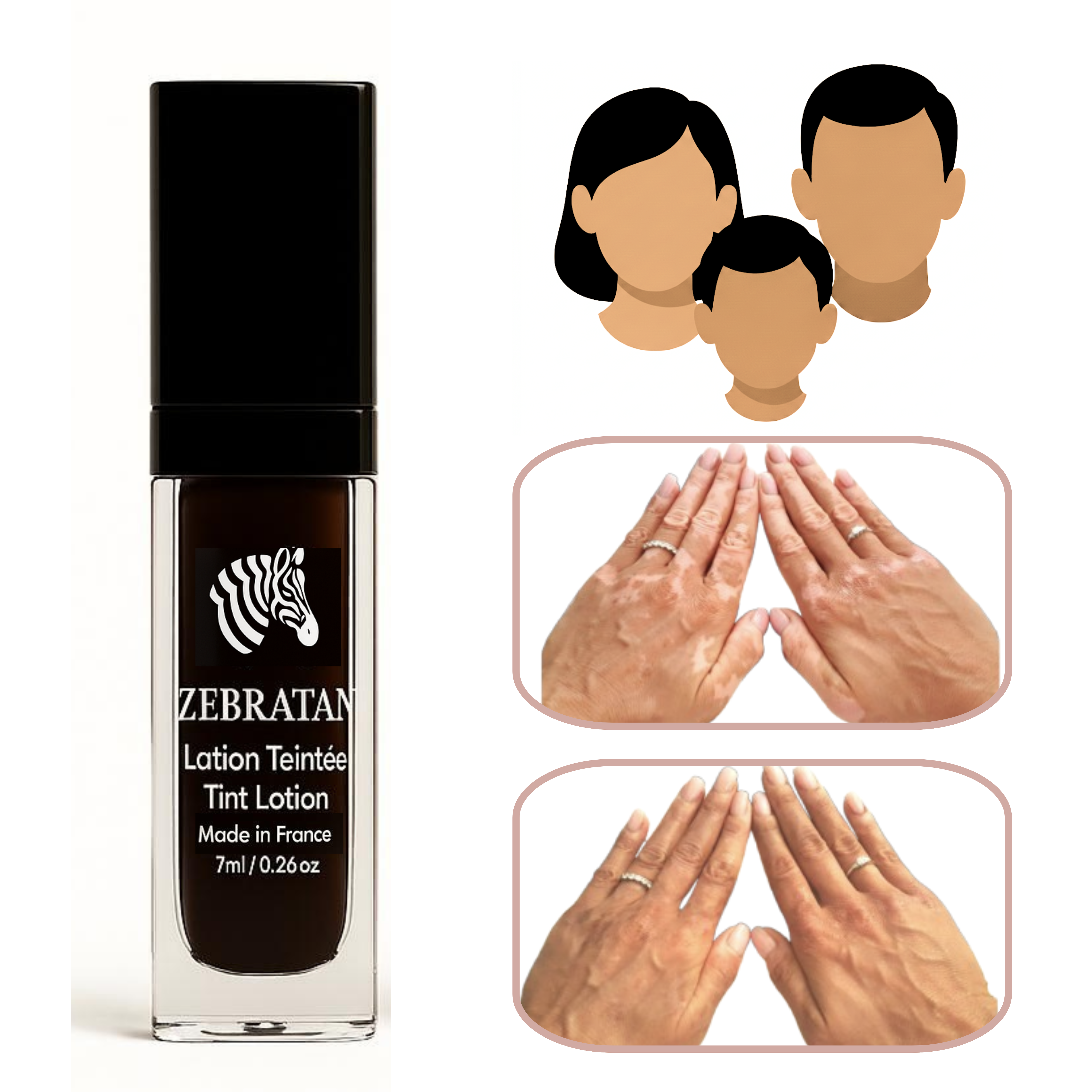 Zebratan Beige Brown – Unisex Vitiligo Make-up-Lotion für Gesicht und Körper