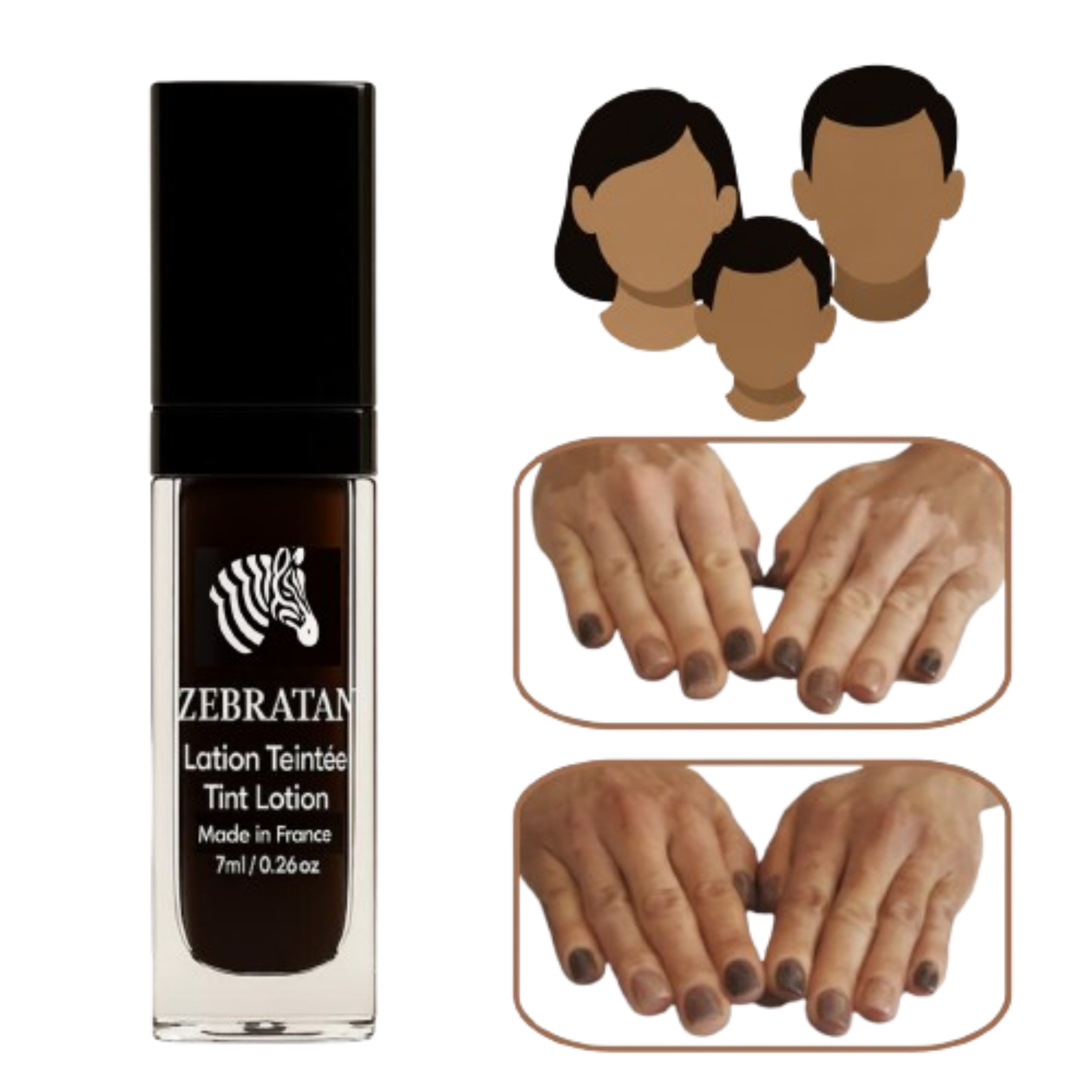 Zebratan Mittelbraun – Unisex Vitiligo Make-up-Lotion für Gesicht und Körper