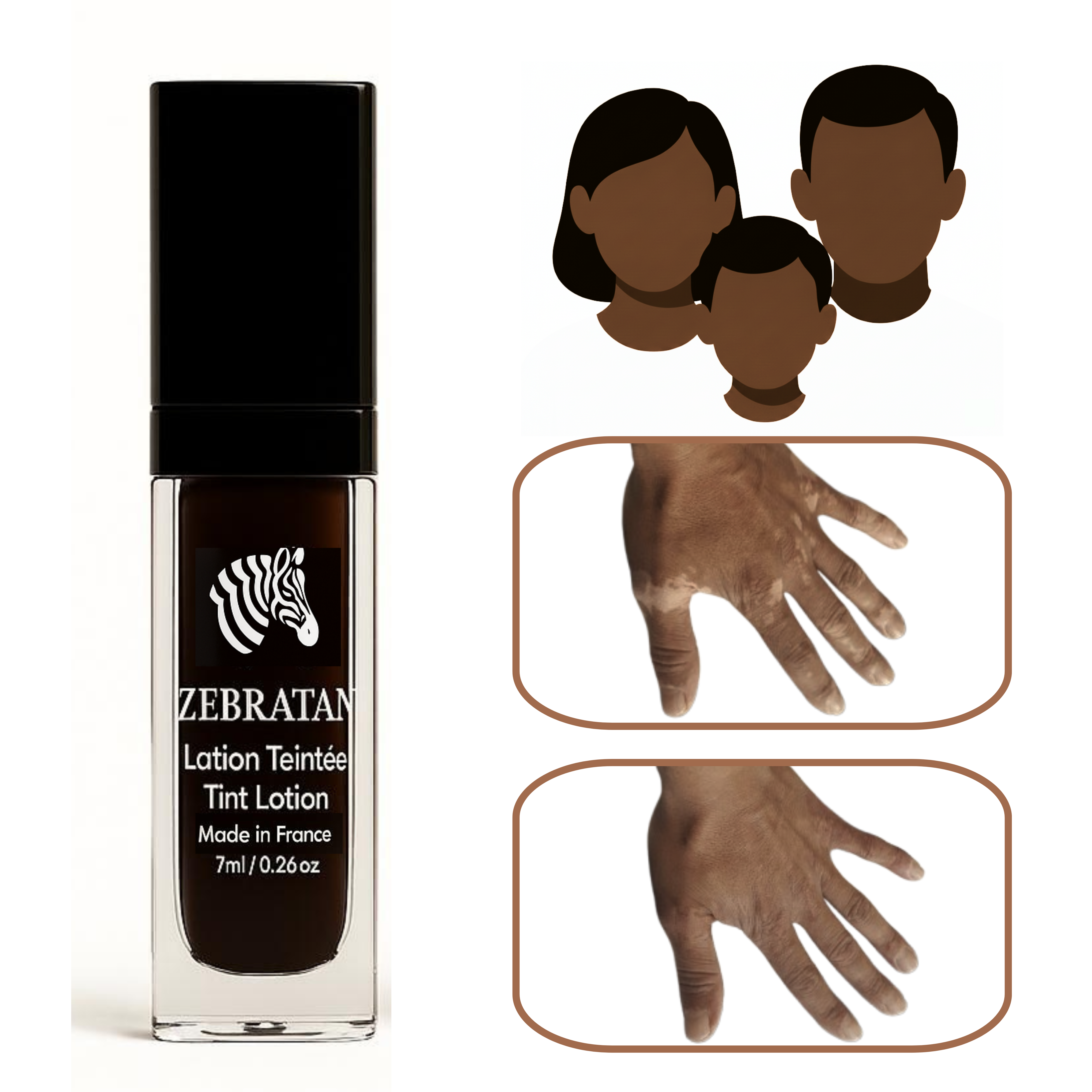 Zebratan Marron Profond – Lotion de maquillage mixte du vitiligo pour visage et corps